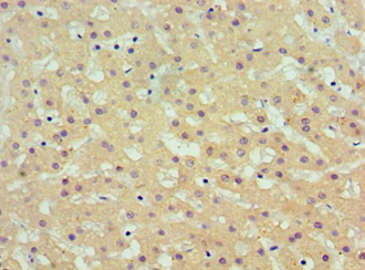 AKR1C4 / Chlordecone Reductase Antibody - Immunohistochemistry of paraffin-embedded human liver using antibody at 1:100 dilution.