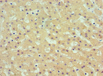 AKR1C4 / Chlordecone Reductase Antibody - Immunohistochemistry of paraffin-embedded human liver tissue using AKR1C4 Antibody at dilution of 1:100