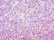 AKR1C4 / Chlordecone Reductase Antibody - Immunohistochemistry of paraffin-embedded human tonsil using antibody at 1:100 dilution.