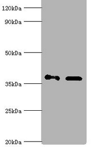 AKR1C4 / Chlordecone Reductase Antibody - Western blot All lanes: Aldo-keto reductase family 1 member C4 antibody at 7µg/ml Lane 1: Hela whole cell lysate Lane 2: HepG 2 whole cell lysate Secondary Goat polyclonal to rabbit IgG at 1/10000 dilution Predicted band size: 37 kDa Observed band size: 37 kDa