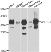AKR1C4 / Chlordecone Reductase Antibody - Western blot analysis of extracts of various cell lines.