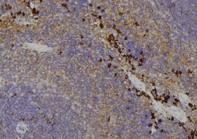 AKR1C4 / Chlordecone Reductase Antibody - 1:100 staining human lymph node tissue by IHC-P. The sample was formaldehyde fixed and a heat mediated antigen retrieval step in citrate buffer was performed. The sample was then blocked and incubated with the antibody for 1.5 hours at 22°C. An HRP conjugated goat anti-rabbit antibody was used as the secondary.