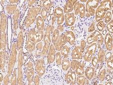 AKR1C4 / Chlordecone Reductase Antibody - Immunochemical staining of human AKR1C4 in human kidney with rabbit polyclonal antibody at 1:100 dilution, formalin-fixed paraffin embedded sections.