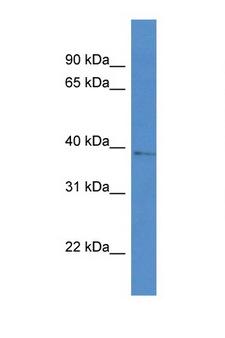 AKR1D1 Antibody - AKR1D1 antibody Western blot of 8226 Cell lysate. Antibody concentration 1 ug/ml.  This image was taken for the unconjugated form of this product. Other forms have not been tested.