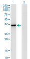 AKR1D1 Antibody - Western Blot analysis of AKR1D1 expression in transfected 293T cell line by AKR1D1 monoclonal antibody (M01), clone 1A6.Lane 1: AKR1D1 transfected lysate(37.4 KDa).Lane 2: Non-transfected lysate.