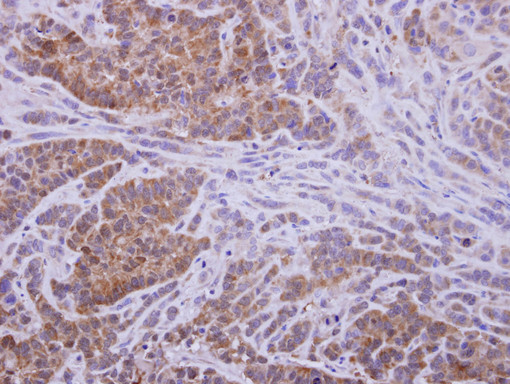 AKR1D1 Antibody - IHC of paraffin-embedded A549 xenograft, using AKR1D1 antibody at 1:500 dilution.