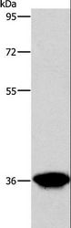 AKR1D1 Antibody - Western blot analysis of Human liver cancer tissue, using AKR1D1 Polyclonal Antibody at dilution of 1:650.