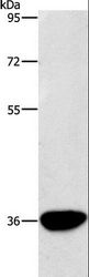 AKR1D1 Antibody - Western blot analysis of Human liver cancer tissue, using AKR1D1 Polyclonal Antibody at dilution of 1:450.
