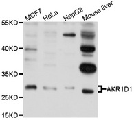 AKR1D1 Antibody - Western blot analysis of extract of various cells.