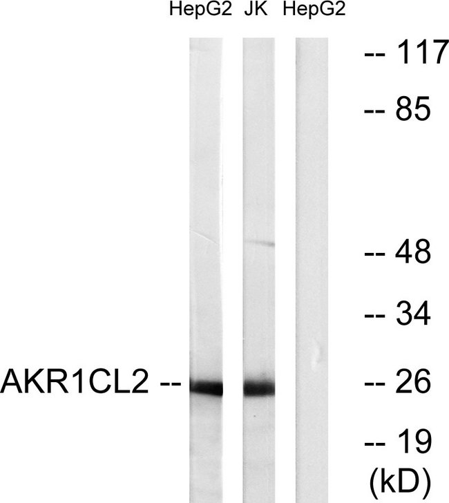 AKR1E2 Antibody - Western blot analysis of lysates from HepG2 and Jurkat cells, using AKR1CL2 Antibody. The lane on the right is blocked with the synthesized peptide.