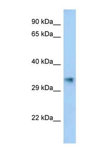 AKR1E2 Antibody - AKR1E2 / AKR1CL2 antibody Western blot of Fetal Lung lysate. Antibody concentration 1 ug/ml.  This image was taken for the unconjugated form of this product. Other forms have not been tested.