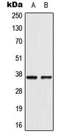 AKR1E2 Antibody - Western blot analysis of AKR1CL2 expression in VEC (A); A549 (B) whole cell lysates.