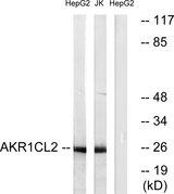 AKR1E2 Antibody - Western blot analysis of extracts from HepG2 cells and Jurkat cells, using AKR1CL2 antibody.