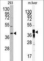 AKR7A2 / AFAR Antibody - Western blot of anti-AKR7A2 antibody in 293 cell line lysates (35 ug/lane). AKR7A2 (arrow) was detected using the purified antibody. Western blot of anti-AKR7A2 Antibody in mouse liver tissue lysates (35 ug/lane). AKR7A2 (arrow) was detected using the purified antibody.