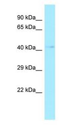 AKR7A2 / AFAR Antibody - AKR7A2 / AFAR antibody Western Blot of Human Liver.  This image was taken for the unconjugated form of this product. Other forms have not been tested.