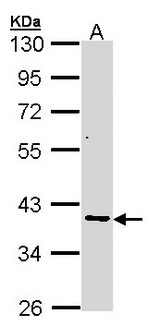 AKR7A2 / AFAR Antibody - Sample (30 ug of whole cell lysate). A: A431 . 10% SDS PAGE. AKR7A2 / AFAR antibody diluted at 1:1000.