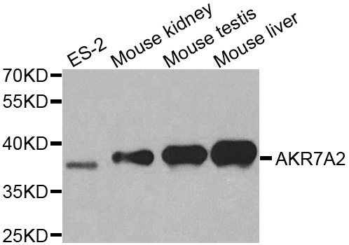 AKR7A2 / AFAR Antibody - Western blot analysis of extracts of various cell lines.