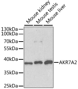 AKR7A2 / AFAR Antibody - Western blot analysis of extracts of various cell lines, using AKR7A2 antibody at 1:1000 dilution. The secondary antibody used was an HRP Goat Anti-Rabbit IgG (H+L) at 1:10000 dilution. Lysates were loaded 25ug per lane and 3% nonfat dry milk in TBST was used for blocking. An ECL Kit was used for detection.