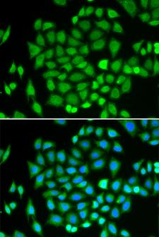 AKR7A2 / AFAR Antibody - Immunofluorescence analysis of HeLa cells using AKR7A2 antibody. Blue: DAPI for nuclear staining.