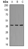 AKR7A2 / AFAR Antibody - Western blot analysis of AKR7A2 expression in ES2 (A); mouse kidney (B); mouse liver (C) whole cell lysates.
