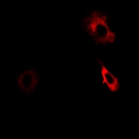 AKR7A2 / AFAR Antibody - Immunofluorescent analysis of AKR7A2 staining in HeLa cells. Formalin-fixed cells were permeabilized with 0.1% Triton X-100 in TBS for 5-10 minutes and blocked with 3% BSA-PBS for 30 minutes at room temperature. Cells were probed with the primary antibody in 3% BSA-PBS and incubated overnight at 4 deg C in a humidified chamber. Cells were washed with PBST and incubated with a DyLight 594-conjugated secondary antibody (red) in PBS at room temperature in the dark.