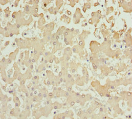 AKR7A2 / AFAR Antibody - Immunohistochemistry of paraffin-embedded human liver tissue at dilution 1:100
