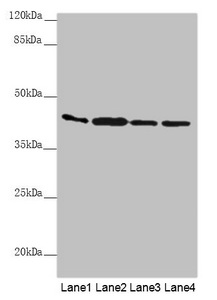 AKR7A2 / AFAR Antibody - Western blot All Lanes: AKR7A2 antibody at 0.88 ug/ml Lane 1: Mouse small intestine tissue Lane 2: Mouse liver tissue Lane 3: Mouse gonadal tissue Lane 4: A431 whole cell lysate Secondary Goat polyclonal to rabbit IgG at 1/10000 dilution Predicted band size: 40 kDa Observed band size: 40 kDa
