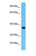 AKR7A2 / AFAR Antibody - Western blot of ARK72 Antibody with human Fetal Lung lysate.  This image was taken for the unconjugated form of this product. Other forms have not been tested.