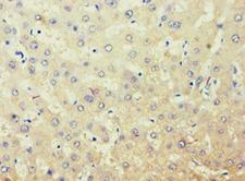 AKR7A3 Antibody - Immunohistochemistry of paraffin-embedded human liver using antibody at 1:100 dilution.