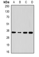 AKR7A3 Antibody - Western blot analysis of AKR7A3 expression in HepG2 (A); HT29 (B); mouse kidney (C); mouse liver (D) whole cell lysates.