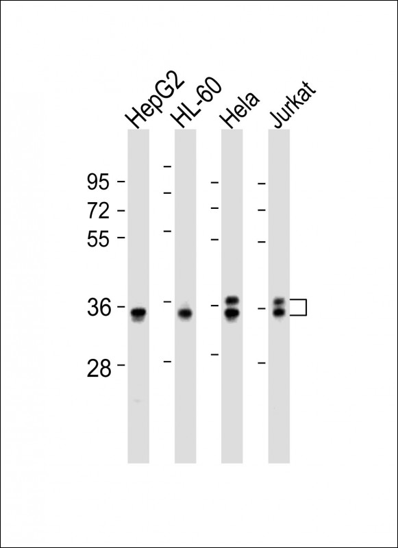 AKR7L Antibody - All lanes: Anti-AKR7L Antibody (Center) at 1:2000 dilution Lane 1: HepG2 whole cell lysates Lane 2: HL-60 whole cell lysates Lane 3: Hela whole cell lysates Lane 4: Jurkat whole cell lysates Lysates/proteins at 20 µg per lane. Secondary Goat Anti-Rabbit IgG, (H+L), Peroxidase conjugated at 1/10000 dilution Predicted band size: 37 kDa Blocking/Dilution buffer: 5% NFDM/TBST.