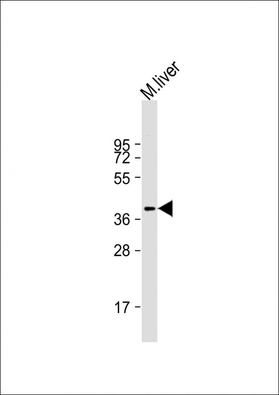 AKR7L Antibody - Anti-AKR7L Antibody (Center)at 1:1000 dilution + mouse liver lysates Lysates/proteins at 20 µg per lane. Secondary Goat Anti-Rabbit IgG, (H+L), Peroxidase conjugated at 1/10000 dilution Predicted band size: 37 kDa Blocking/Dilution buffer: 5% NFDM/TBST.