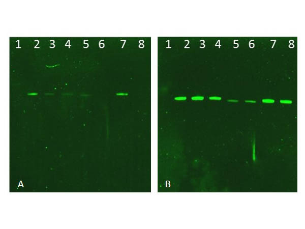 AKT1 + AKT2 + AKT3 Antibody - Western Blot of rabbit AKT Antibody. Lane 1: NIR MW protein ladder. Lane 2: AKT1, recombinant. Lane 3: AKT1, phosphatase-treated. Lane 4: AKT1, mutant T308A/S473A. Lane 5: AKT2, recombinant. Lane 6: AKT2, phosphatase-treated. Lane 7: AKT3, recombinant. Lane 8: AKT3, phosphatase-treated. Load: 50ng per lane. Blot A: 600-401-269 Anti-Akt pT308 used at 1:2270, Blot B: 100-401-401 Anti-Akt used 1:1000.