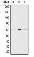 AKT1 + AKT2 + AKT3 Antibody - Western blot analysis of AKT expression in HeLa (A); NIH3T3 (B); PC12 (C) whole cell lysates.