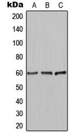 AKT1 + AKT2 + AKT3 Antibody - Western blot analysis of AKT expression in Jurkat (A); HeLa (B); NIH3T3 (C) whole cell lysates.