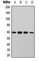 AKT1 + AKT2 + AKT3 Antibody - Western blot analysis of AKT (pT450) expression in HeLa (A); HepG2 colchicine-treated (B); NIH3T3 UV-treated (C); PC12 H2O2-treated (D) whole cell lysates.