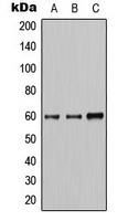 AKT1 + AKT2 + AKT3 Antibody - Western blot analysis of AKT expression in HeLa (A); A549 (B); HepG2 (C) whole cell lysates.