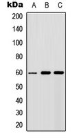 AKT1 + AKT2 + AKT3 Antibody - Western blot analysis of AKT expression in MCF7 (A); NIH3T3 (B); PC12 (C) whole cell lysates.