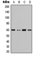 AKT1 + AKT2 + AKT3 Antibody - Western blot analysis of AKT expression in MCF7 (A); A549 (B); NIH3T3 (C); rat muscle (D) whole cell lysates.