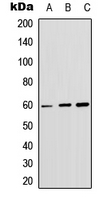 AKT1 + AKT2 + AKT3 Antibody - Western blot analysis of AKT (pS246) expression in HepG2 (A); K562 (B); NIH3T3 (C) whole cell lysates.