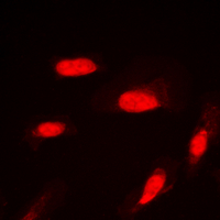 AKT1 + AKT2 + AKT3 Antibody - Immunofluorescent analysis of AKT (pS246) staining in HepG2 cells. Formalin-fixed cells were permeabilized with 0.1% Triton X-100 in TBS for 5-10 minutes and blocked with 3% BSA-PBS for 30 minutes at room temperature. Cells were probed with the primary antibody in 3% BSA-PBS and incubated overnight at 4 ??C in a humidified chamber. Cells were washed with PBST and incubated with a DyLight 594-conjugated secondary antibody (red) in PBS at room temperature in the dark. DAPI was used to stain the cell nuclei (blue).