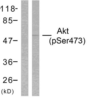 AKT1 + AKT2 + AKT3 Antibody - Western blot analysis of lysates from HeLa cells treated with heat shock, using Akt (Phospho-Ser473) Antibody. The lane on the left is blocked with the phospho peptide.