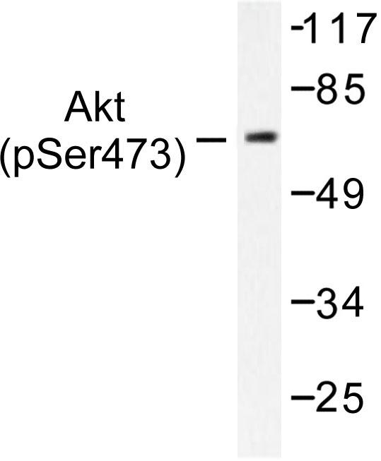 AKT1 + AKT2 + AKT3 Antibody - Western blot of p-Akt (S473) pAb in extracts from 293 cells treated with TNF-a 20ng/ml 30'.