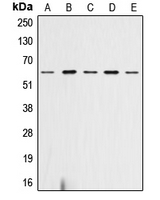AKT1 + AKT2 + AKT3 Antibody - Western blot analysis of AKT (pS473) expression in HeLa (A); SP2/0 (B); mouse heart (C); rat heart (D); rat liver (E) whole cell lysates.