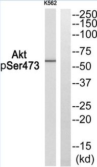 AKT1 + AKT2 + AKT3 Antibody - Western blot of extracts from K562, using Akt (Phospho-Ser473) Antibody.