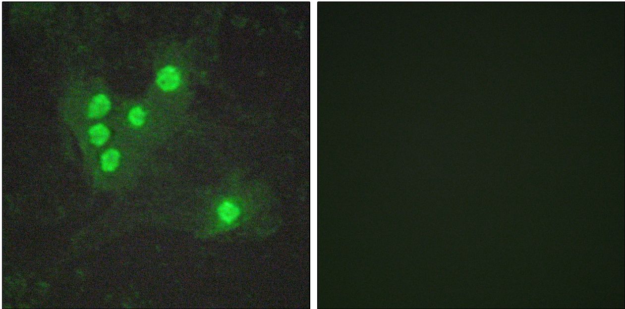 AKT1 + AKT2 + AKT3 Antibody - Immunofluorescence of A549 cells, using Akt (Phospho-Ser473) Antibody