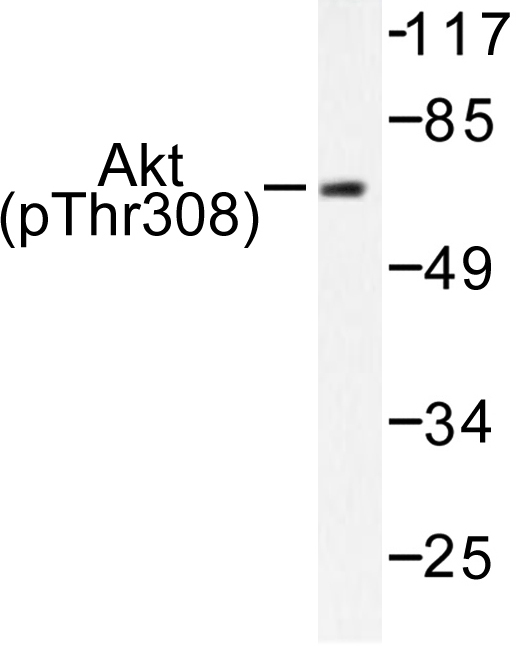 AKT1 + AKT2 + AKT3 Antibody - Western blot of p-Akt (T308) pAb in extracts from 293 cells treated with EGF 200ng/ml 5'.