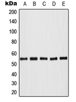 AKT1 + AKT2 + AKT3 Antibody - Western blot analysis of AKT (pT308) expression in HeLa colchicine-treated (A); HL60 (B); NIH3T3 (C); SP2/0 colchicine-treated (D); PC12 colchicine-treated (E) whole cell lysates.
