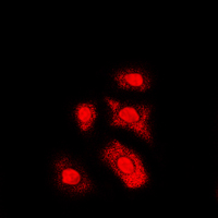 AKT1 + AKT2 + AKT3 Antibody - Immunofluorescent analysis of AKT (pT308) staining in HL60 cells. Formalin-fixed cells were permeabilized with 0.1% Triton X-100 in TBS for 5-10 minutes and blocked with 3% BSA-PBS for 30 minutes at room temperature. Cells were probed with the primary antibody in 3% BSA-PBS and incubated overnight at 4 C in a humidified chamber. Cells were washed with PBST and incubated with a DyLight 594-conjugated secondary antibody (red) in PBS at room temperature in the dark. DAPI was used to stain the cell nuclei (blue).