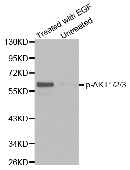 AKT1 + AKT2 + AKT3 Antibody - Western blot analysis of extracts from HepG2 cells untreated or treated with EGF.